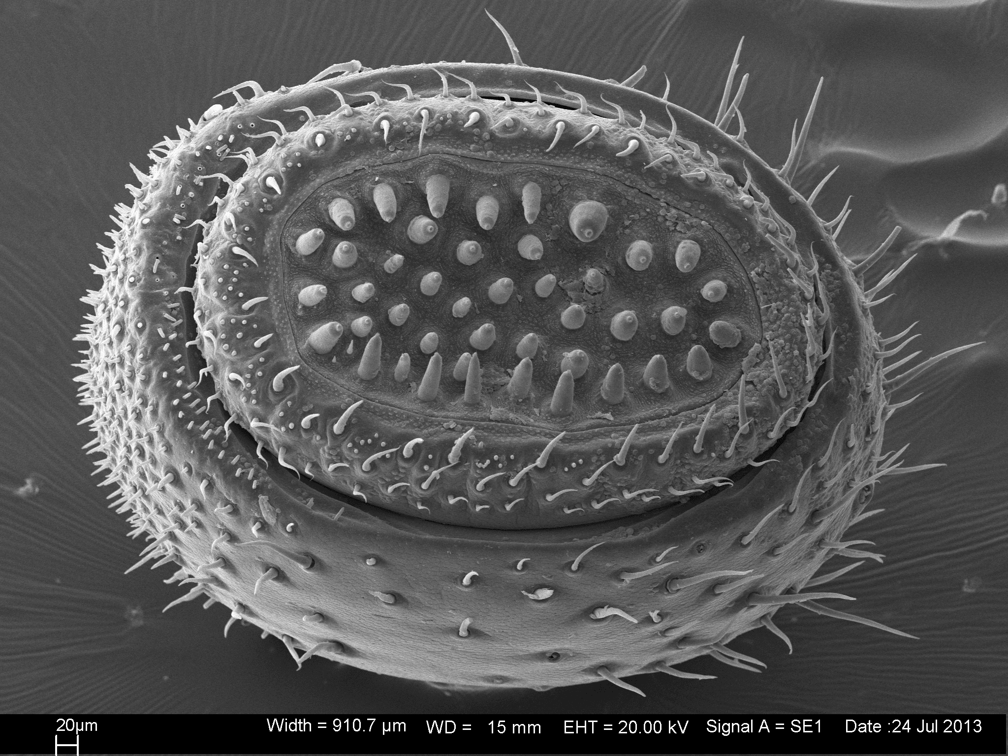 A microscopic view of an ovular antenna tip. The exterior is covered in thin hairs. At its center, it is concave, with thicker, shorter, finger-like protrusions.